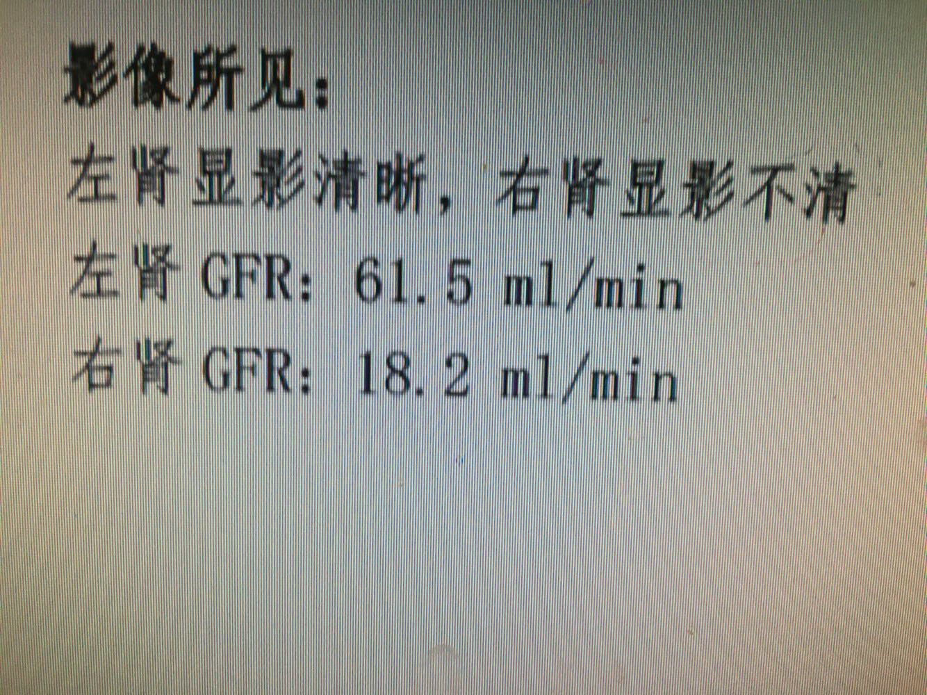 肾盏憩室结石并积水一例_医学界-助力医生临床决策和职业成长